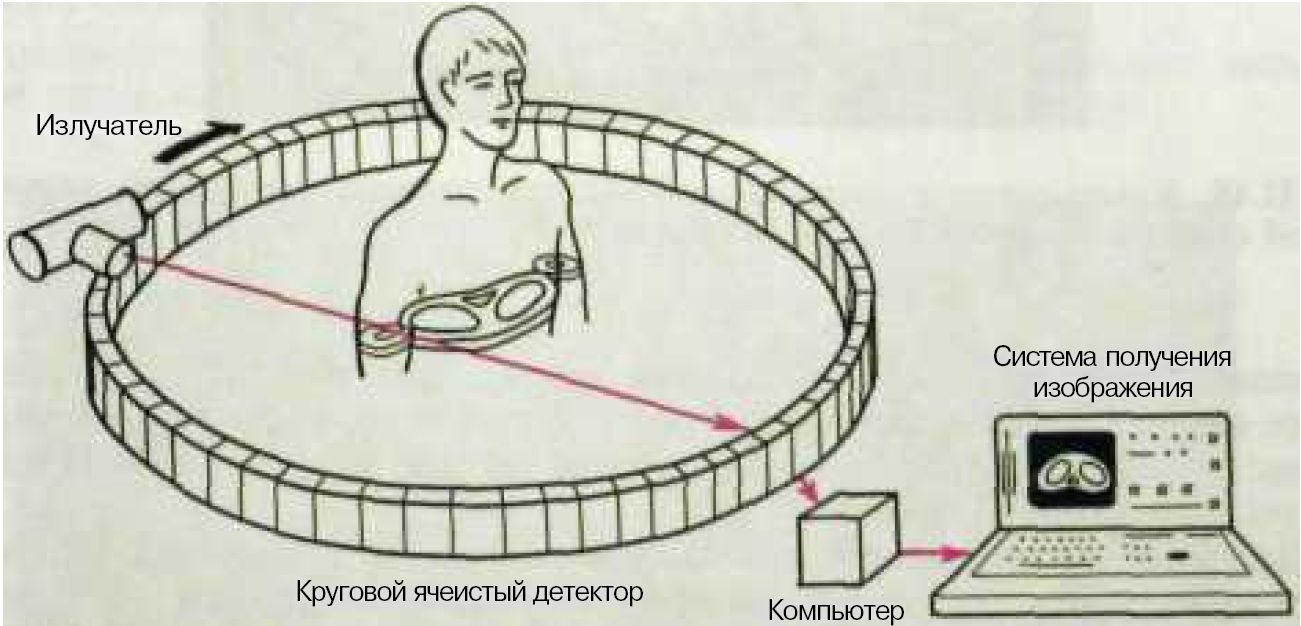 Схема получения изображения кт