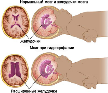 Патология головного мозга