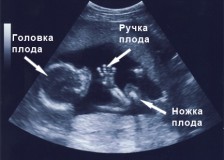 Показатели УЗИ на 17 неделе беременности