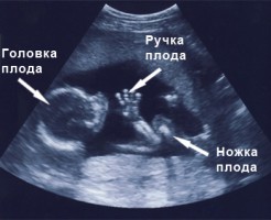 Показатели УЗИ на 17 неделе беременности