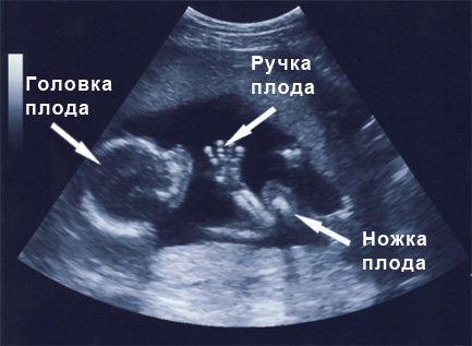 Ребенок на 17 неделе беременности