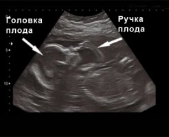 Необходимость проведения УЗИ во втором триместре беременности