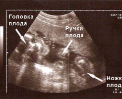 Развитие ребенка, видимое на УЗИ к 24 неделе беременности
