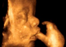 Завершающее УЗИ третьего триместра беременности