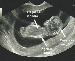 Определение изменений по фото размера плода на УЗИ на 9 неделе беременности