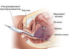 Проведение УЗИ при беременности на раннем сроке