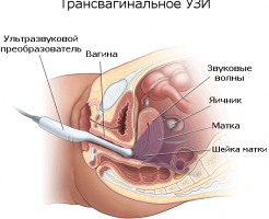 Проведение УЗИ при беременности на раннем сроке