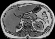 Трехформатное изображение на МРТ брюшной полости