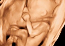 Сбор информации о ребенке на втором УЗИ при беременности