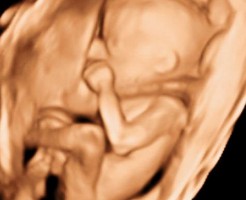 Сбор информации о ребенке на втором УЗИ при беременности