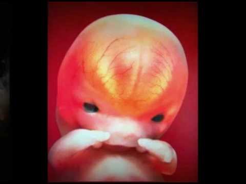 6 неделя развития эмбриона