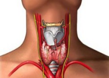 Признаки заболевания на УЗИ щитовидной железы