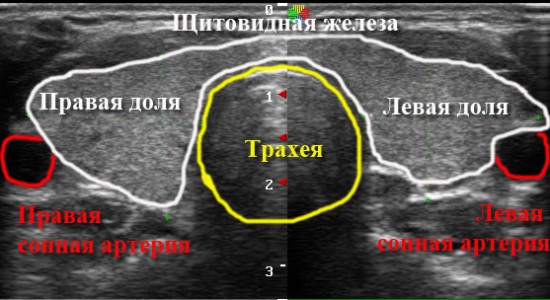 Щитовидная железа на ультразвуковом обследовании