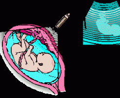 Вопрос вреда УЗИ при беременности для плода