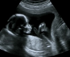 Уникальные фото УЗИ размеров плода на 15 неделе беременности