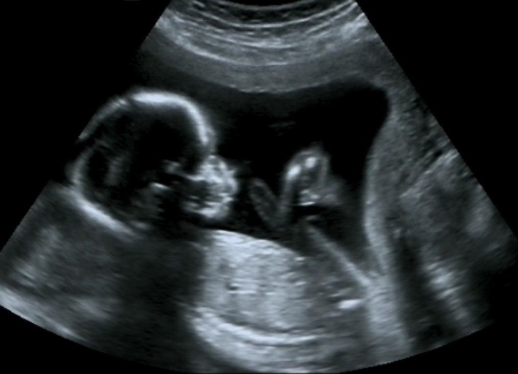 Фото ребенка в утробе