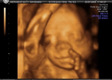 Внеплановое УЗИ на 23 неделе беременности
