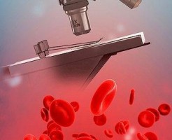 Как сдавать клинический анализ крови?