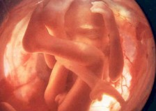 Что можно увидеть на фото с УЗИ на 26 неделе беременности?