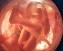Что можно увидеть на фото с УЗИ на 26 неделе беременности?