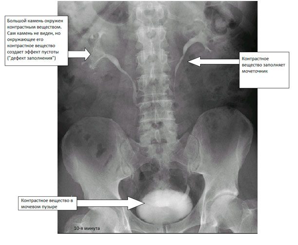 Видимость органов на рентгеновском снимке