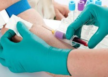 Расшифровка и нормы показателя MCV в анализе крови