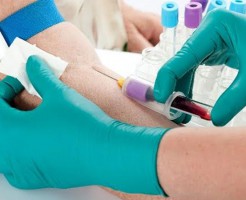 Расшифровка и нормы показателя MCV в анализе крови