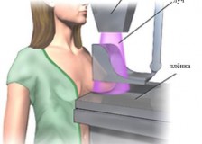 Какой метод лучше – УЗИ или маммография молочной железы?