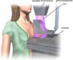 Какой метод лучше – УЗИ или маммография молочной железы?