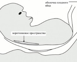 Нормы биохимического скрининга 1 триместра беременности