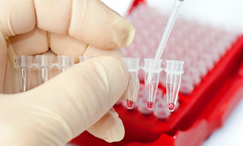 Проведение HCV анализа крови