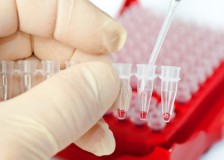 На что указывает HCV и Anti-HCV в анализе крови?