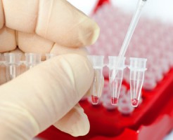 На что указывает HCV и Anti-HCV в анализе крови?
