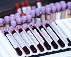 Таблица норм биохимического анализа крови у взрослых