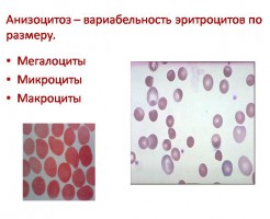 Выявление анизоцитоза в общем анализе крови