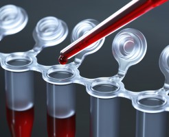 Внутриклеточный фермент АСТ в биохимическом анализе крови