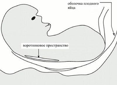 Воротниковое пространство у эмбриона