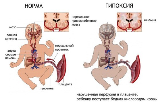 Определение гипоксии