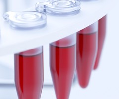 Рекомендации по подготовке к биохимическому анализу крови