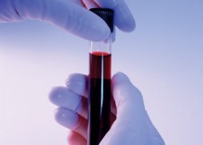Зачем берут анализ крови из вены?