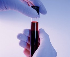 Зачем берут анализ крови из вены?