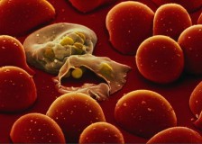 Метод диагностики паразитов по анализу крови на глисты