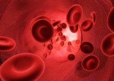Определение причин пойкилоцитоза в общем анализе крови