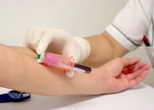 Что такое АЛТ и АлАТ в анализе крови?