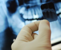 Вредно ли делать рентген зуба при беременности?