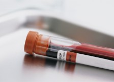 Есть ли отличия общего анализа крови от клинического?