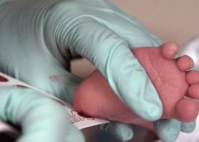 Что такое неонатальный скрининг новорожденного?