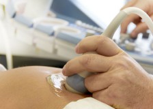 С какой целью делают допплерографию при беременности?