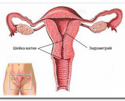 Дополнительная профилактическая мера — УЗИ шейки матки при беременности
