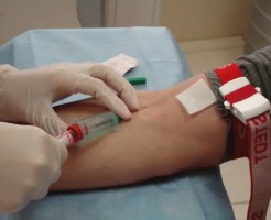 Проведение общего анализа крови